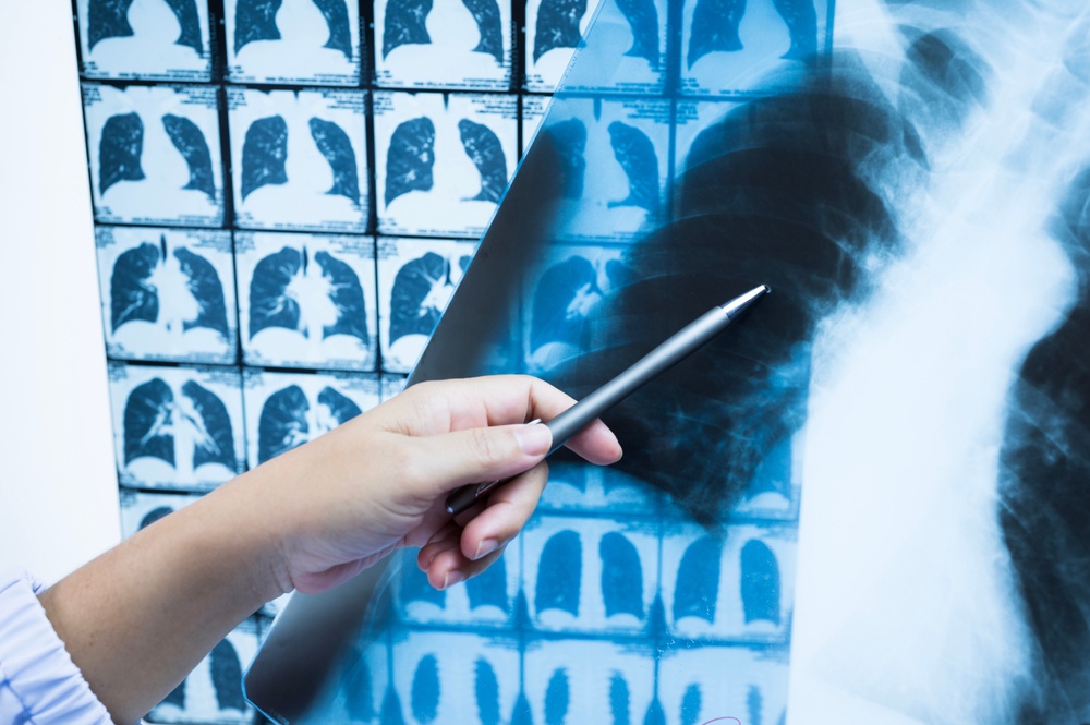 hand pointing toward concern on lung imaging