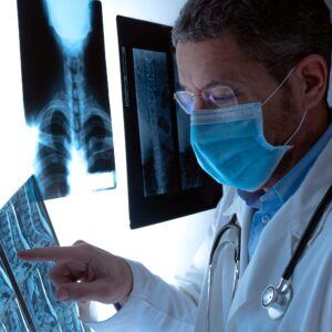 Doctor reviewing xray