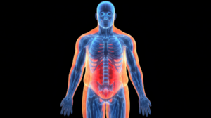 Voiant obesity dxa scan medical illustration body full bone muscle fat composition front thumbnail for clinical trial imaging endpoint delivery metabolic biomarkers CRO contract research organization