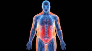 Voiant obesity dxa scan medical illustration body full bone muscle fat composition front thumbnail clinical trial imaging cro metabolic diseases GLP-1 biomarker endpoint analysis